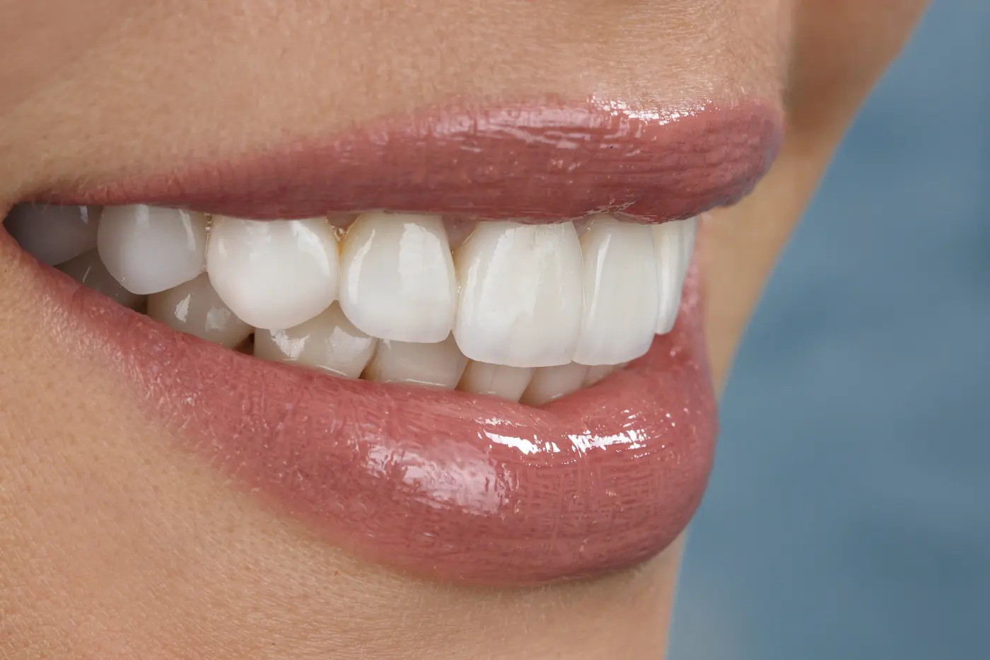 Full Mouth Rehabilitation